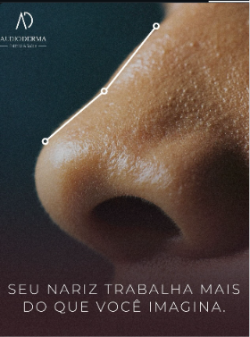 Post Instagram Audioderma