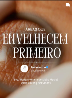 Post Instagram Audioderma