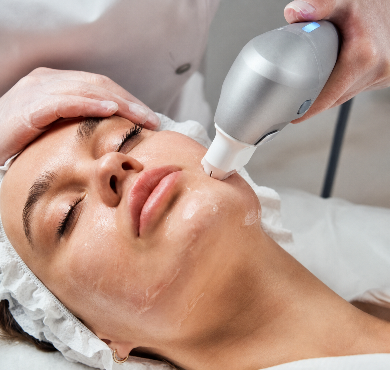 Aplicação facial de ultrassom micro e macrofocado Ultraformer